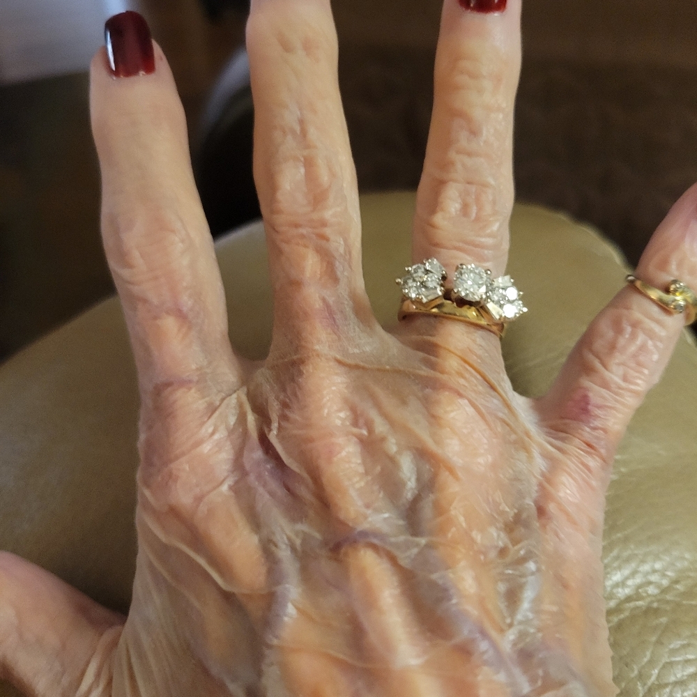 Yellow Gold And Diamond Wedding Set - Picture 4 of 10